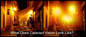 what does cataracts vision look like