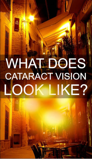 https://ethosvision.net/wp-content/uploads/2022/12/what-does-cataracts-vision-look-vbS.jpg