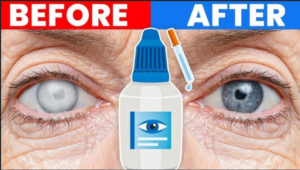 dr berg eye drops for cataracts
