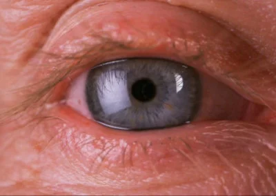 Ethos Bright Eyes Eye Drops